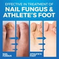 thumbnail image 3 of Athletes Foot Shoe Spray for Fungal Nail Treatment | Athletes Foot & Anti Toe Nail Fungus Treatment and Foot Fungus | Ringworm Foot Care Shoe Freshener | 150 ML, 3 of 8
