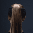 thumbnail image 2 of ExoShield Head Guard, 2 of 2