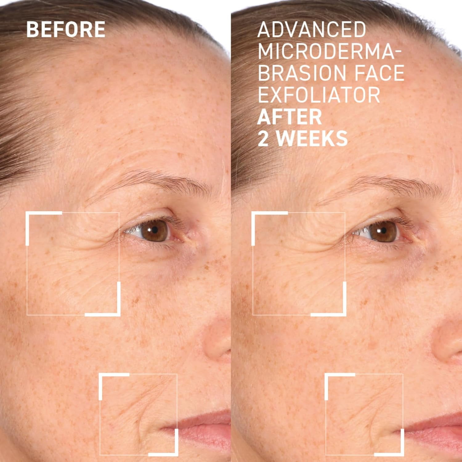 Dr. Brandt Advanced Microdermabrasion Face Exfoliator