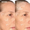 thumbnail image 6 of Dr. Brandt Advanced Microdermabrasion Face Exfoliator, 6 of 11