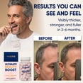 thumbnail image 4 of MOÉRIE Ultimate Beauty Boost Hair Growth Supplements, 1 pack - 60 capsules, 4 of 8