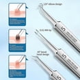 thumbnail image 5 of Ultra-fine No. 5 Acne Needle Acne Clips Stainless Steel Cell Pimples Blackhead Clip, 5 of 5