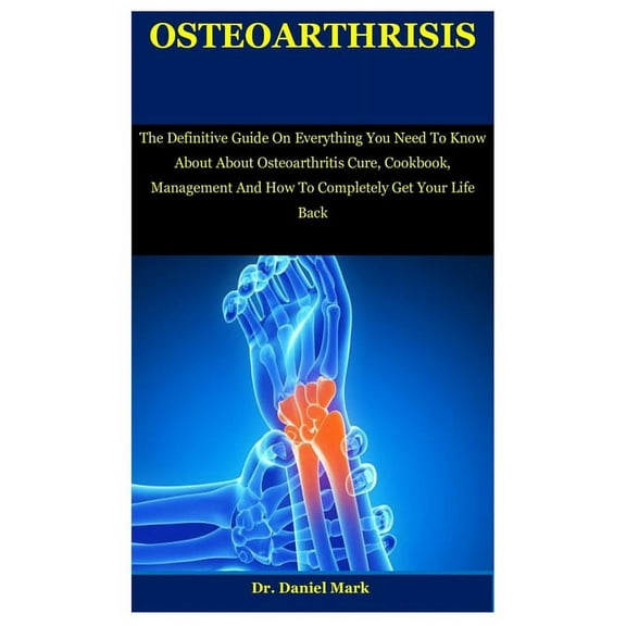 Osteoarthritis : The Definitive Guide On Everything You Need To Know About About Osteoarthritis Cure, Cookbook, Management And How To Completely Get Your Life Back (Paperback)