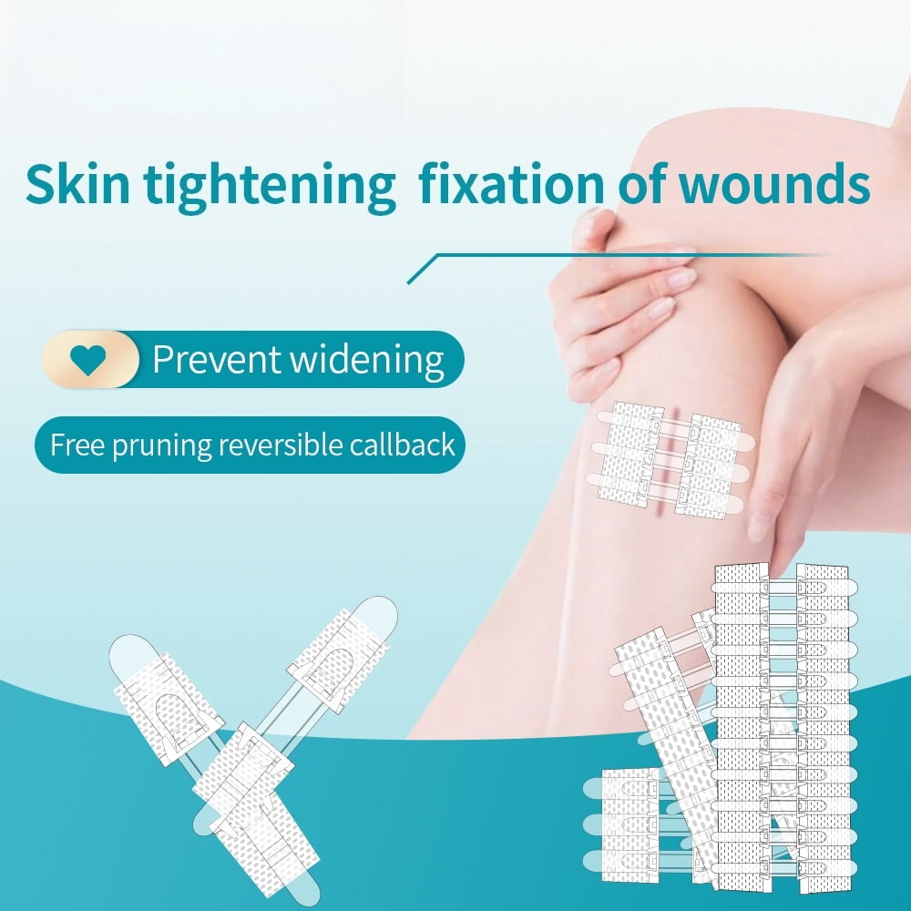Wound Closure Strips for Emergency First Aid, Butterfly Bandages Suture Alternative, Surgical Laceration Repair Without Stitches or Needles (4 Pack)