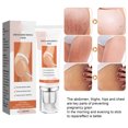 thumbnail image 4 of Scar Removal Cream,  2Pcs Stretch Mark Cream 45g Effective  for Body, 4 of 7