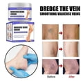 thumbnail image 4 of Vein Rep Cream Vein Cream Buing Pain Leg Varicose Worm Leg Mai Leg Care, 4 of 4