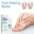 CHOUXX Foot & Heel Balm Spray, For Dry and Cracked Feet & Heels. Foot ...