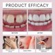 thumbnail image 2 of Adhesivo termoplástico para prótesis dentales que permite reajustar y apretar prótesis dentales sueltas y que duran hasta 4 días, 2 of 5