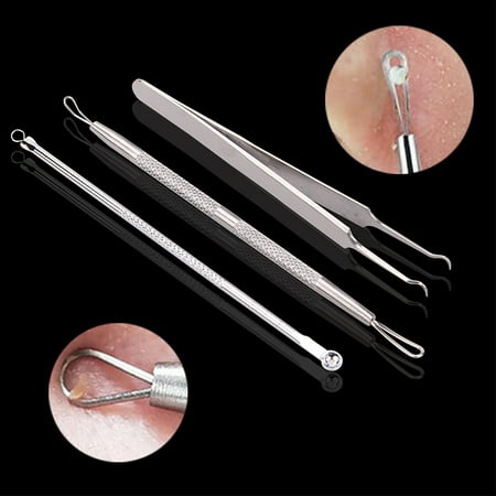 Stainless Steel Blackhead Acne Extractor Pimple Spot Remover Clip Double Head Acne Needle Tool Kit (Best Acne Red Spot Remover)