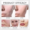 thumbnail image 4 of Facial Peel-Off Mask for Deep Cleansing, Oil Control and Hydration Benefits, 4 of 5