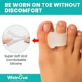 thumbnail image 2 of Welnove 10 Pack Gel Toe Separators Aloe Vera Overlapping Toes Bunion Relief Silicone Corrector for Men Women, 2 of 8