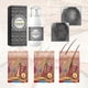 thumbnail image 3 of Jaysuing Rice Water Hair Care Spray Moisturizing Scalp Dense Hair Soft Hair Strong And Tough Hair Fixing Hair Care Spray, 3 of 5