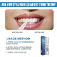 thumbnail image 5 of Beauty Tooth Pen Teeth Oral Care To Remove Yellow Teeth Teeth To Yellow And Black Clean Teeth Pen Beauty Tooth Pen Gel, 5 of 5
