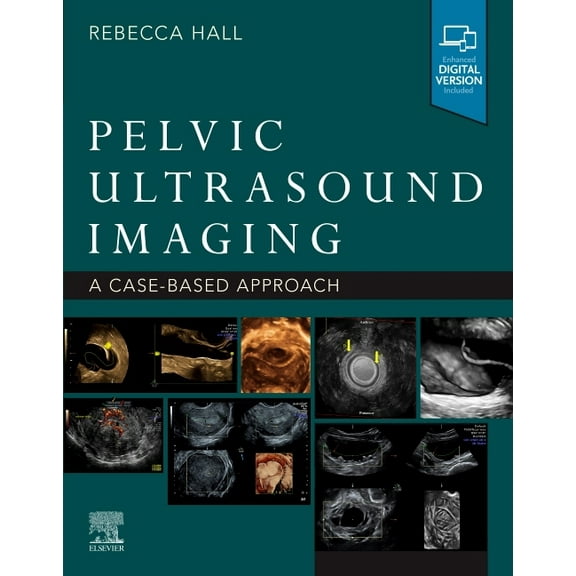 Pelvic Ultrasound Imaging: A Cased-Based Approach, (Paperback)