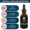 thumbnail image 3 of 30ml/50ml Powerful Nails Care Repair Nail Anti-Fungus Onychomycosis Removal, 3 of 4