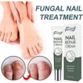 thumbnail image 2 of 2026 Nail Care Nail Repair Cream Nail Fungus Treatment Onychomycosis Nail Carenail Repair Cream Nail Moisturizing Restore Beautiful Nails Fungi Nail F, 2 of 5