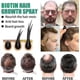 thumbnail image 3 of Biotin hair growth spray anti hair loss fast regeneration scalp treatment essence, 3 of 5