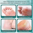 thumbnail image 4 of Electric Callus Remover, Callus Remover, Foot Rechargeable, Pedicure Set, Foot Care, Callus Remover, Foot Care Device, Electric Foot File with 3 Repla, 4 of 5
