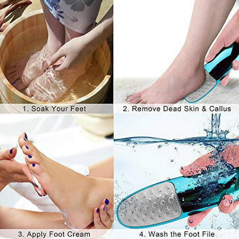 Foot Scrubber with Holder, Never-Cut-Your-Skin Callus Remover for