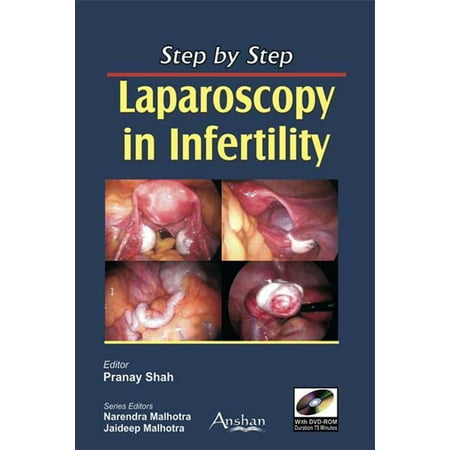 UPC: 9781905740666 | Step by Step: Step by Step Laparoscopy in Infertility (Paperback)