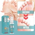 thumbnail image 2 of Athlete's Foot Athlete's Foot Effectively Resolves Foot Itching And For Athlete's Foot Foot Sweat And Foot 50ml, 2 of 5