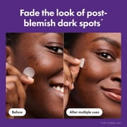 Hero Cosmetics Mighty Patch Micropoint for Dark Spots, Post-Blemish Dark Spot Patch, 8 Count