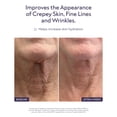 thumbnail image 3 of Sérum hidratante ALASTIN Skincare Restorative Neck Complex, 3 of 8