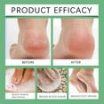 Foot Soak Lymphatic Drainage Foot Soak Natural Herb Foot Bath Bag Leg