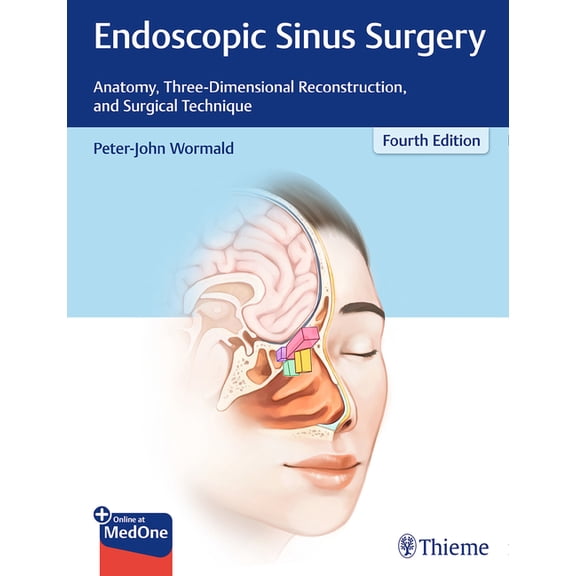 Endoscopic Sinus Surgery: Anatomy, Three-Dimensional Reconstruction, and Surgical Technique, (Hardcover)