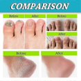 thumbnail image 5 of Natural Foot & Nail Spray Powerful Anti-Fungal Treatment for Athlete's Foot Odor Control Foot Care Liquid Spray, 5 of 5