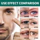 thumbnail image 4 of Rodillo para El Cuidado de Los Ojos | Masaje para El Cuidado de La Piel de Los Ojos | Hidratación y Humectación (8 Ml) | Reduce La Fatiga y Mejora La Visión | Rodillo para Mejorar La Visión, 4 of 7