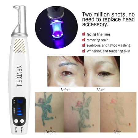 - Tattoo Removal Laser Pen, Spot Removal Laser Pen,Handheld Picosecond Laser Pen Tattoo Scar Freckle Removal Machine Skin Beauty Device