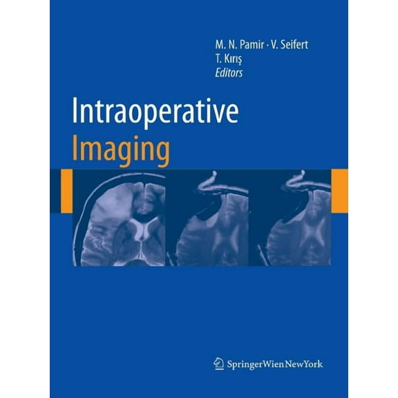 ACTA Neurochirurgica Supplement Intraoperative Imaging, Book 109, (Paperback)