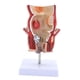 thumbnail image 3 of Modelo rectal de patología humana, herramienta de visualización educativa científica, herramienta intuitiva y didáctica, modelo anatómico para, 3 of 9