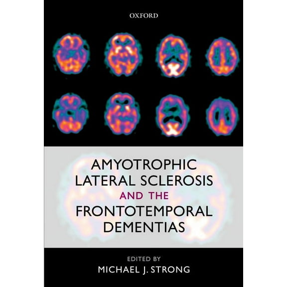 Amyotrophic Lateral Sclerosis and the Frontotemporal Dementias, (Hardcover)