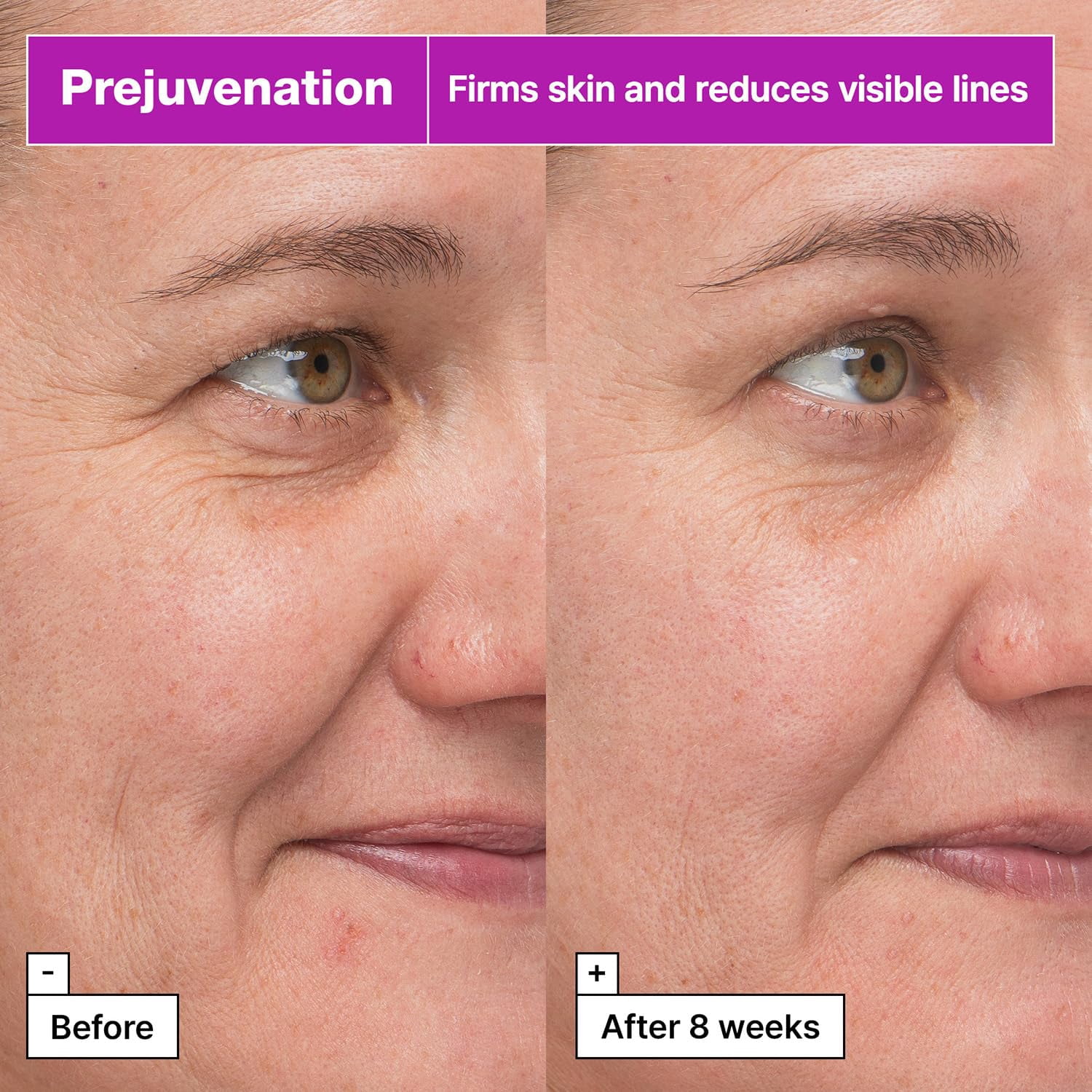 Dr.Jart+ Prejuvenation Firming Bakuchiol Serum - 1.69fl oz 50ml Korean Anti Aging Serum