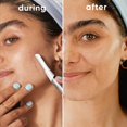 thumbnail image 5 of Kit de herramientas de dermaplaning Gillette Venus con 5 recambios de cuchillas, 5 of 5