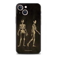 thumbnail image 3 of Funda de teléfono con forma de corazón y cuerpo de pizarra con esqueleto de anatomía para iPhone 13, 15, 14, 12, 11 Pro MAX XR X SE XS 7 8 Plus, funda protectora suave, 3 of 5