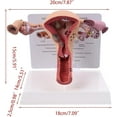 thumbnail image 6 of Pathological Uterus Ovary Model, Female Reproductive Organ Model Human Uterus Anatomical Model with Educational Display Card and Base, for Teaching Learning, 6 of 8