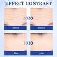 thumbnail image 5 of Mascarillas faciales para el cuidado de la piel (paquete de 10) Parches antiarrugas de hidrogel con colágeno y proteínas Parches antiarrugas Almohadillas para la frente Antiarrugas 30 ml Cuidado de la, 5 of 5