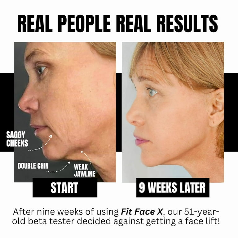 FFX Fit Face X Face Sculpting Kit, 4 facial tools for facial