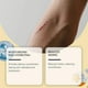 thumbnail image 3 of Keloid Bumps Removal Gel, Advanced Scar Gel for Face & Body, Scar Gel for All Scars & Keloids, 3 of 5