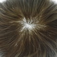 thumbnail image 2 of LYRICAL HAIR Toupee for Men Indian Human Hair Replacement System All Lace Mens Toupee French Lace Hairpieces for Man Bleached Front Knots Mens Hair Piece Unit, 2 of 6