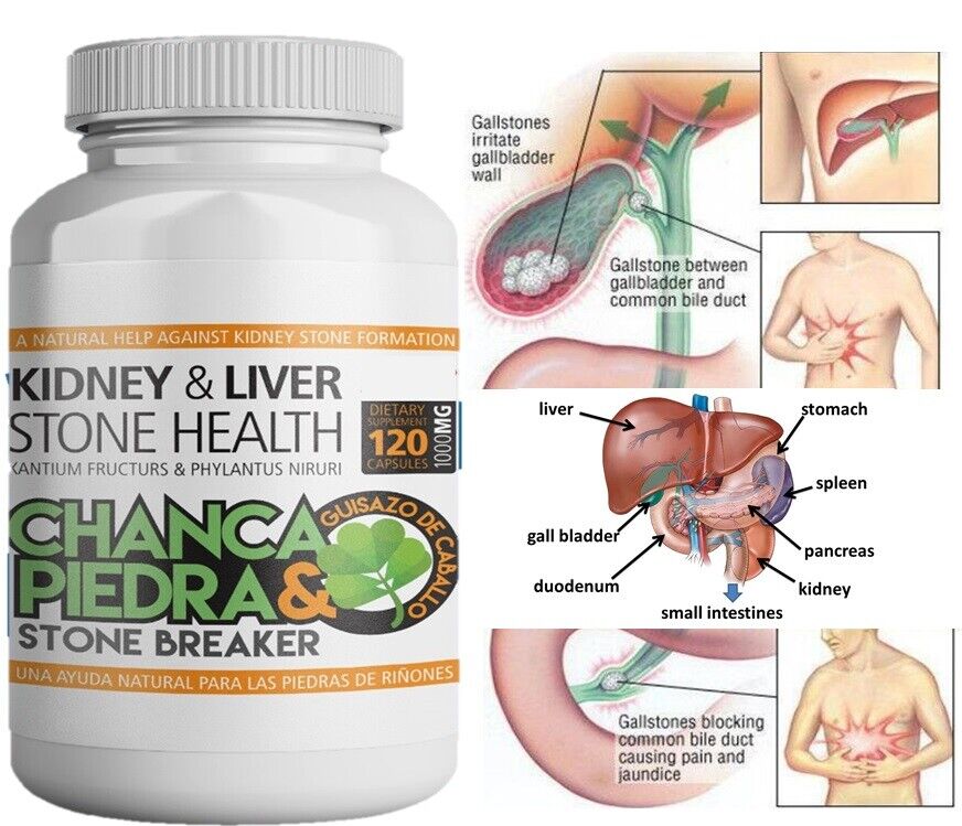Chanca Piedra Stone Breaker Kidney Liver Gallstones Pill 1000mg 120 Capsules