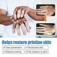 thumbnail image 2 of Vitiligo Skin Repair Cream,Vitiligo Treatment Cream, Dispose of White Spots on Skin and Improve Skin Pigmentation_c*, 2 of 4