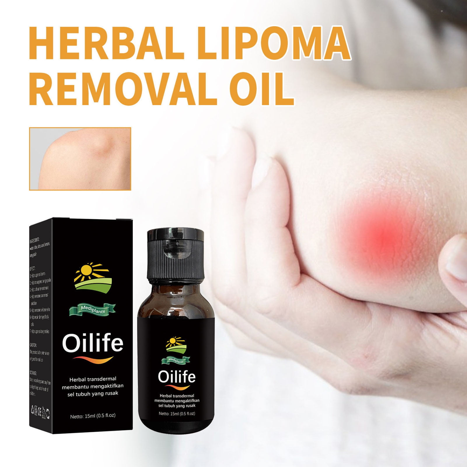 Lipoma Elimination Oil Herbal 2pcs Lipolysis Lump Remover Skin  