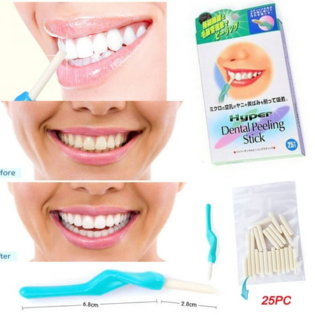 Teeth Whitening Pen Instant Remove Stain Tooth Wipe Pen (Best Instant Teeth Whitening Pen)