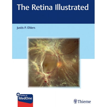 UPC: 9781626238312 | The Retina Illustrated (Paperback)