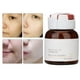 thumbnail image 1 of Suero De Control De Aceite, Eficaz, Práctico, Práctico, 10 Ml, Suero Para Decoloración De Manchas, Para Mujeres Y Niñas ANGGREK Otros, 1 of 8