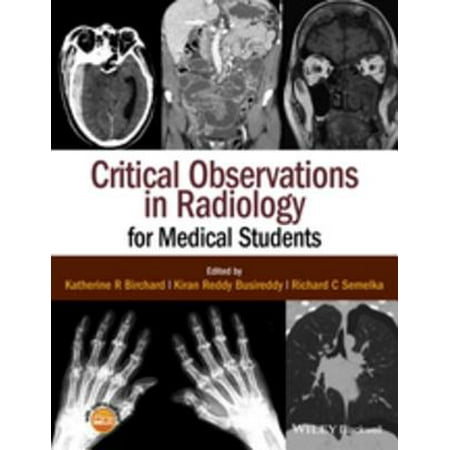 Critical Observations in Radiology for Medical Students -